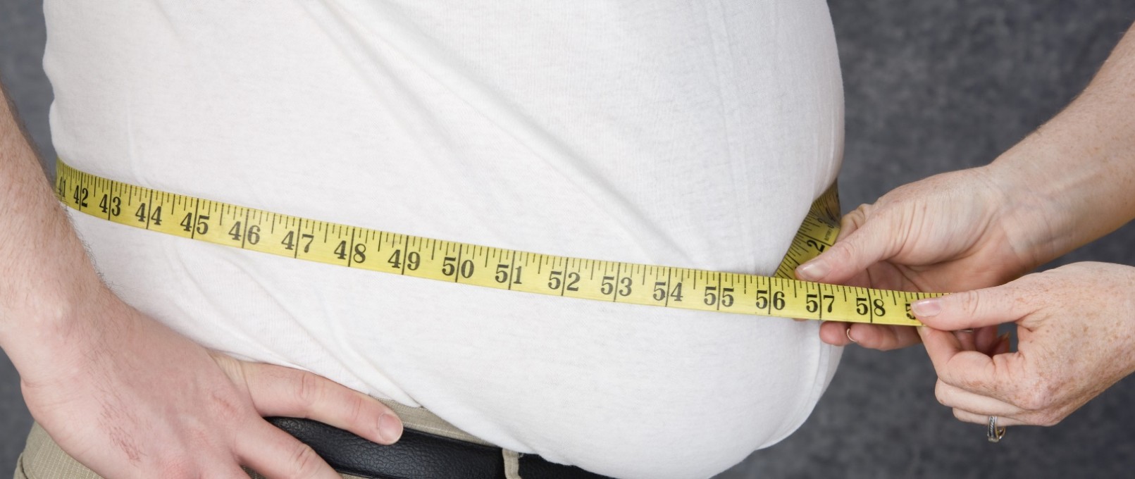 Obesity is no longer your fate with bariatric surgery